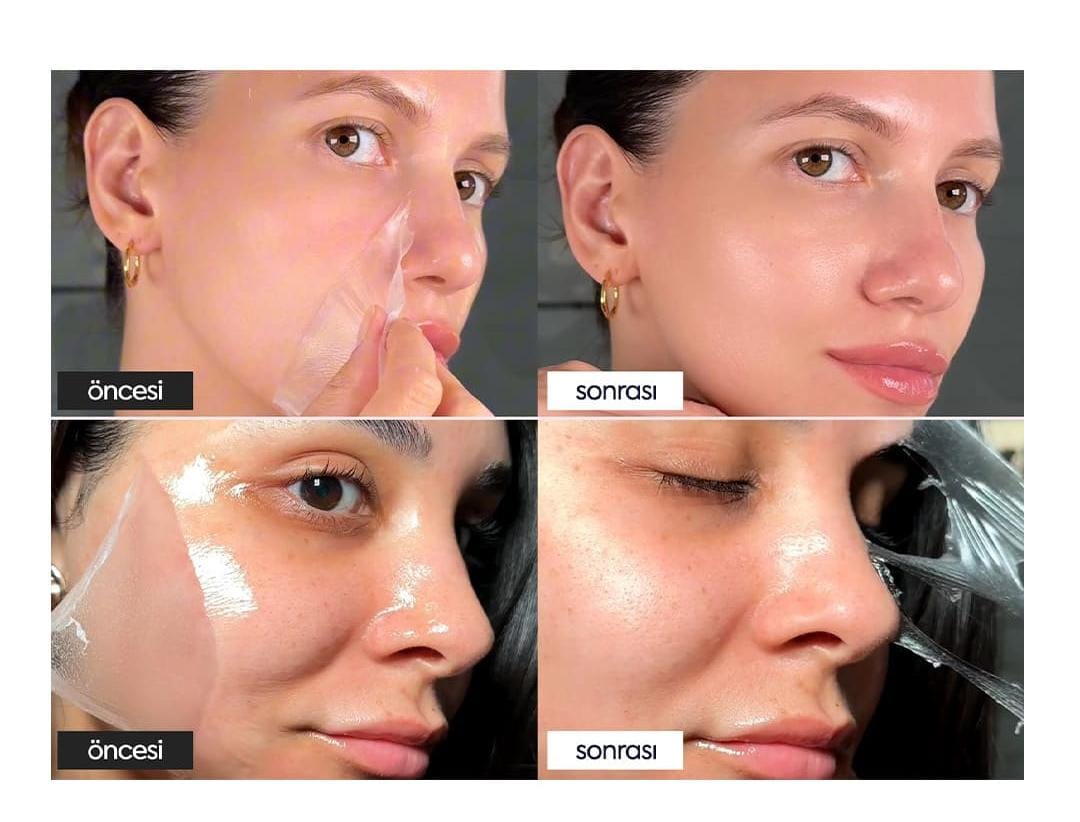 ELOSİA™ Soyulabilir Kolajen Maske
